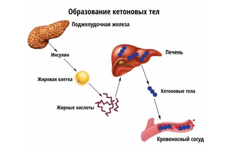 4. Qondagi glyukoza nazorati. Gliklangan gemoglobin. Keton tanachalari